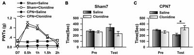 Cingulate Alpha-2A Adrenoceptors Mediate the Effects of Clonidine on Spontaneous Pain Induced by Peripheral Nerve Injury